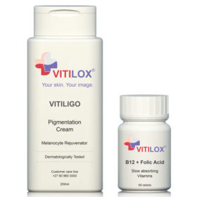 Vitilox® Pigmentation Cream & Vitamins: - Vitiligo Treatment South Africa Vitilox® Vitiligo Pigmentation Cream & Vitamins