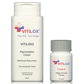 Vitilox® Pigmentation Cream & T-Cell-V - Vitiligo Treatment South Africa Vitilox® Vitiligo Pigmentation Cream & T-Cell-V