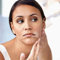 Vitiligo Face Treatment