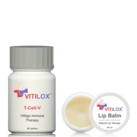 Vitilox® Lip Balm & T-Cell-V Immune Therapy - Vitiligo Treatment South Africa Vitilox® Vitiligo Lip Balm Tcells