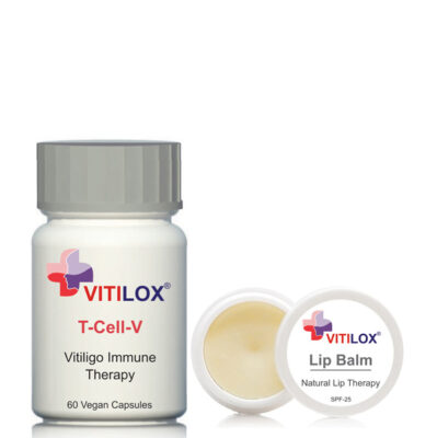 We were advised to use Vitiligo Vitilox® Lip Balm for Claire’s inner lip area & Vitilox® T-Cell-V Immune Therapy capsules - Vitiligo Treatment South Africa Vitiligo Eye Treatment - Case Study